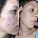 Gomic Beauty -  Morango 30gomas - Imagem 2